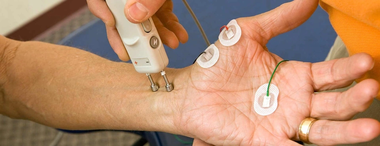 NCS (Nerve Conduction Study)