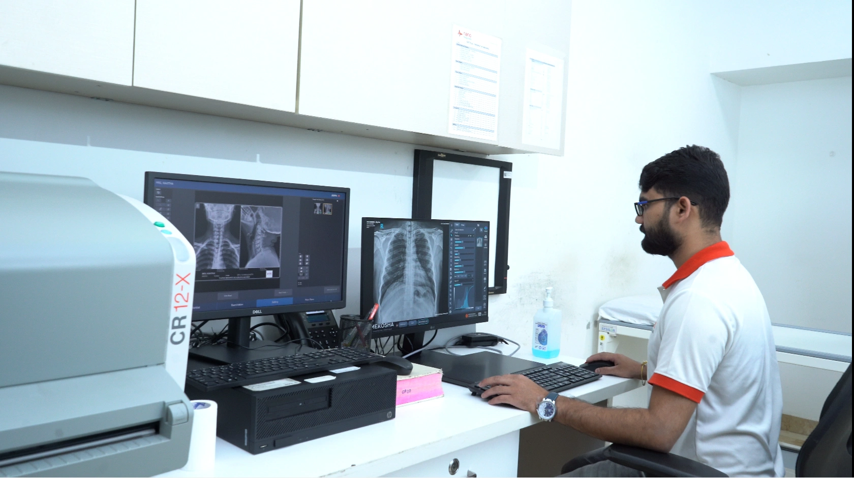 Digital X-Ray