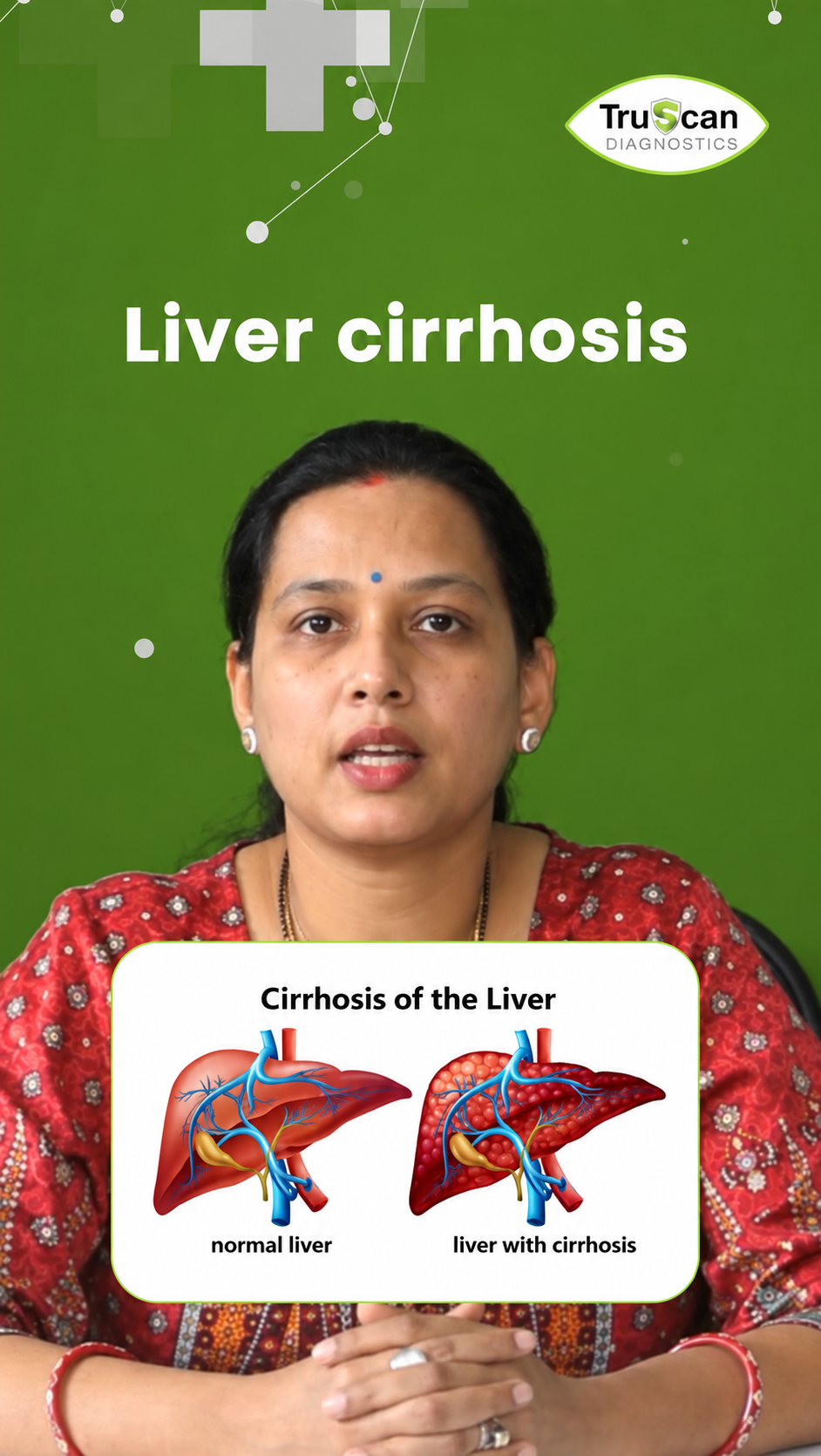 Liver elastography helps detect fatty liver and fibrosis early